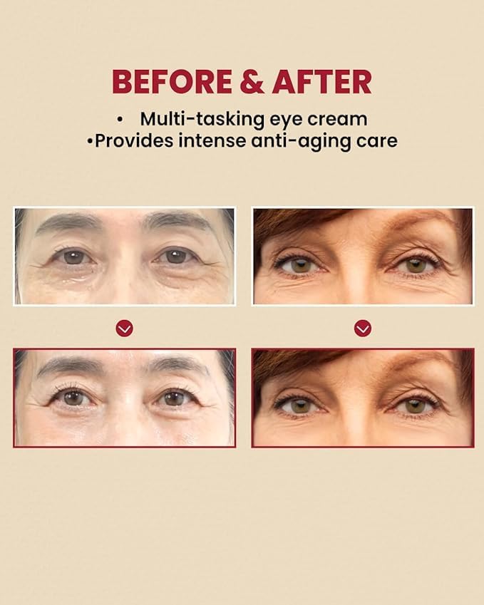 K-Secret SEOUL 1988 Eye Cream  Retinal Liposome 4% + Fermented Bean