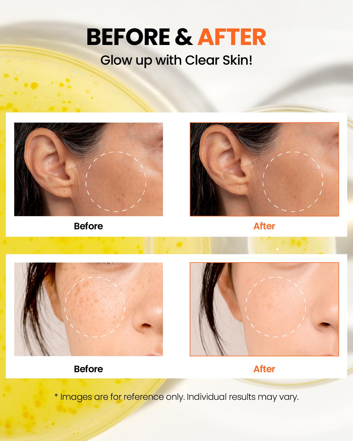 K-Secret SEOUL 1988 Glow Serum: Niacinamide 15% + Yuja