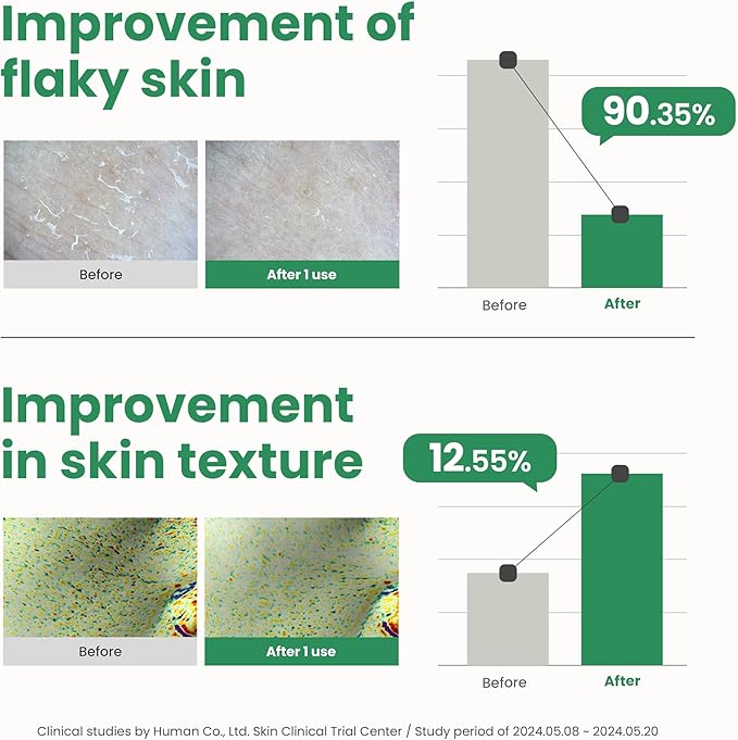 AXIS-Y – PHA Resurfacing Glow Peel