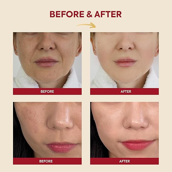 K-Secret  SEOUL 1988 Essence : Snail Mucin 97% + Rice – 100ml