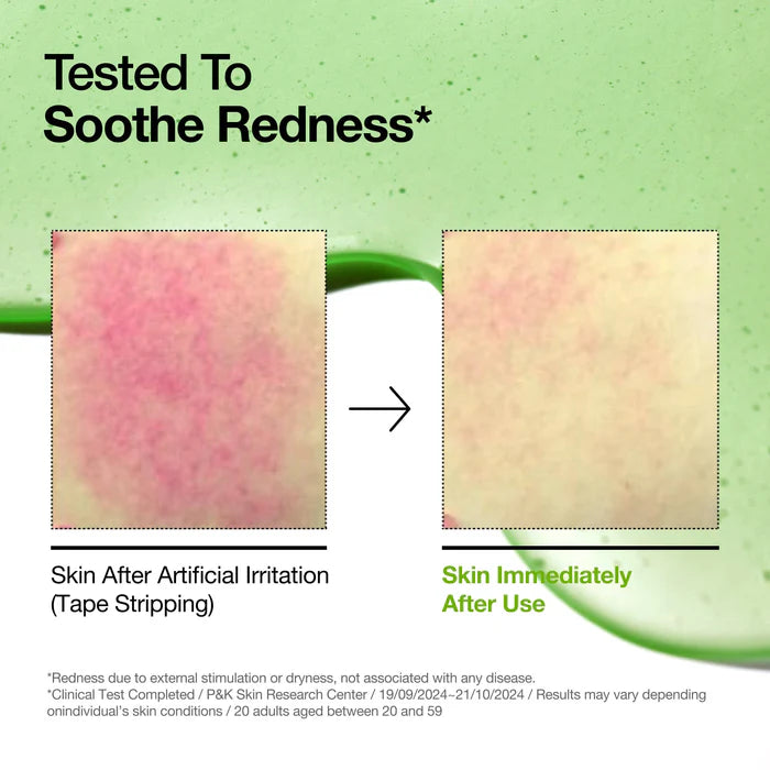 Anua – Azelaic Acid 10 Hyaluron Redness Soothing Serum
